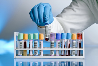 Сдать анализы - Самарский сосудистый центр